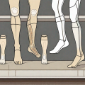 Several types of compression stockings displayed on mannequin legs