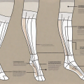 Compression stockings laid out on a flat surface with a step-by-step instructional diagram showing the process of putting them on